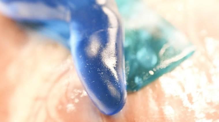 A Revolution in Wound Healing: Scientists Develop Durable, Flexible Bio-Glue