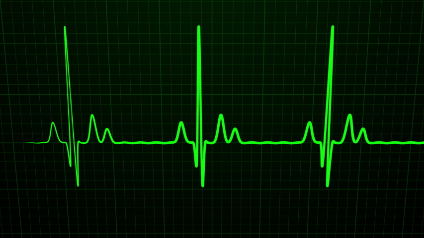 Medical Scientists Roll Out Portable Heart Monitoring Device To Detect Irregularities In Mental Health Patients
