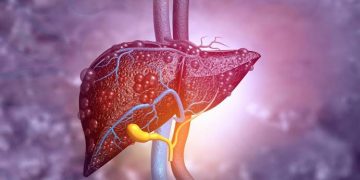 HDL3 “Good Cholesterol” Protects Against Liver Inflammation, New Study Shows