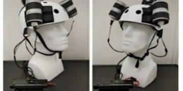 A Helmet Cured Brain Illness Without Chemotherapy