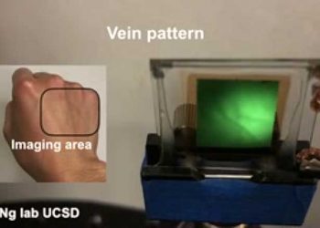 Researchers Develop Infrared Imager That Can Help Map Out A Person’s Blood Vessels Without Touching The Skin