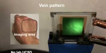 Researchers Develop Infrared Imager That Can Help Map Out A Person’s Blood Vessels Without Touching The Skin