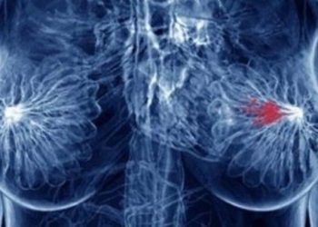 How Artificial Intelligence Is Used To Fight Breast Cancer