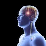 China Approves First Brain Implant for Commercial Use 180423-brain-implant-mn-1350