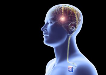 China Approves First Brain Implant for Commercial Use